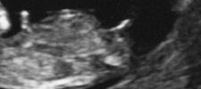2010 02 11   Echographies